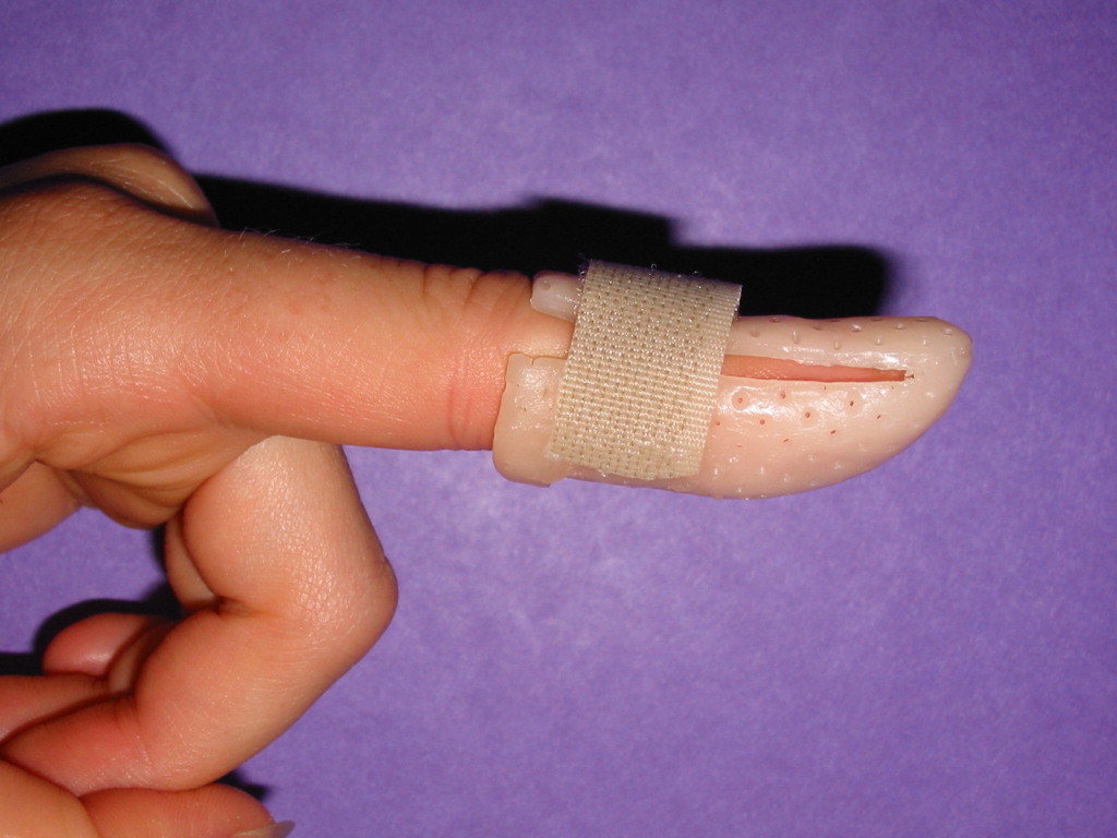 Mallet-Finger-Splint.jpg